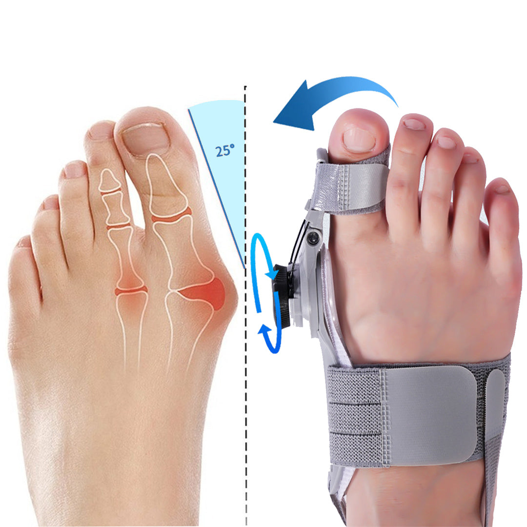 Yashals Wellness™ Bunion Fix - Natural At-Home Bunion Relief